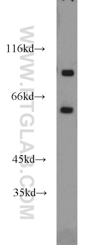 17599-1-AP;mouse brain tissue