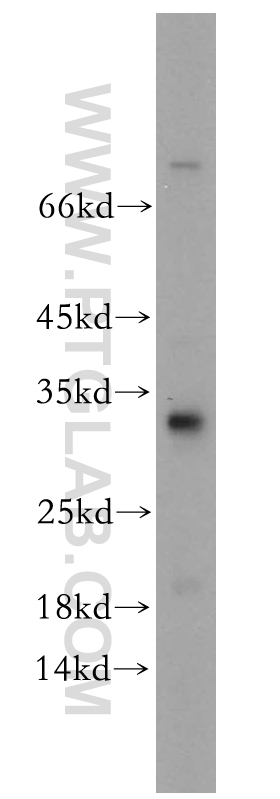 17043-1-AP;mouse brain tissue