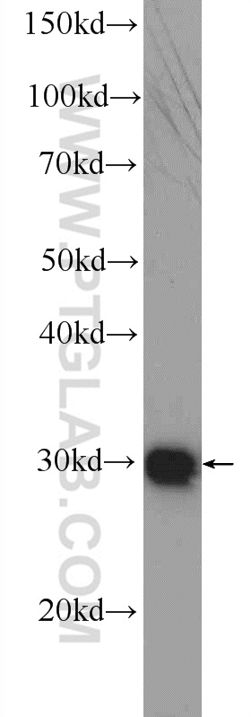 25444-1-AP;HeLa cells