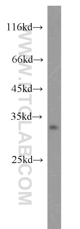 15934-1-AP;HeLa cells