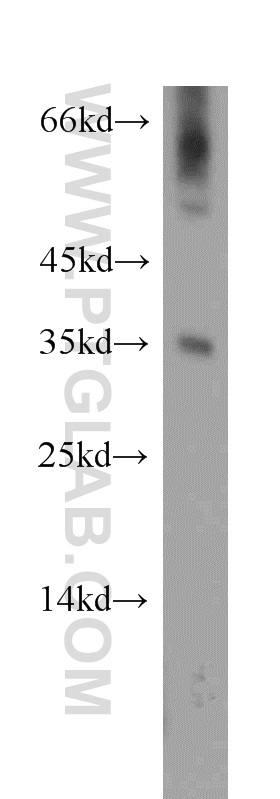 11948-1-AP;mouse liver tissue