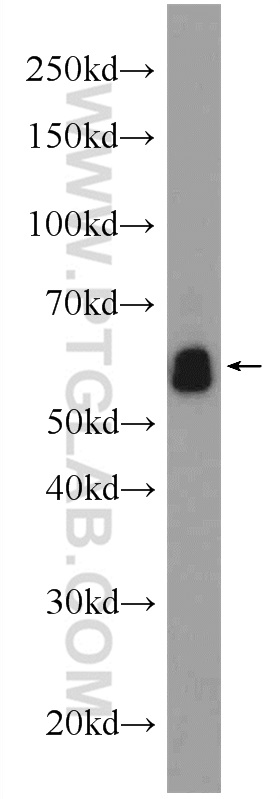 10219-1-AP;mouse brain tissue