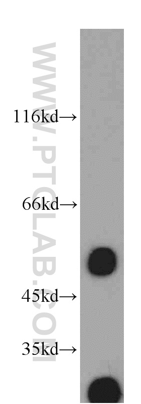 10899-1-AP;rat lymph tissue