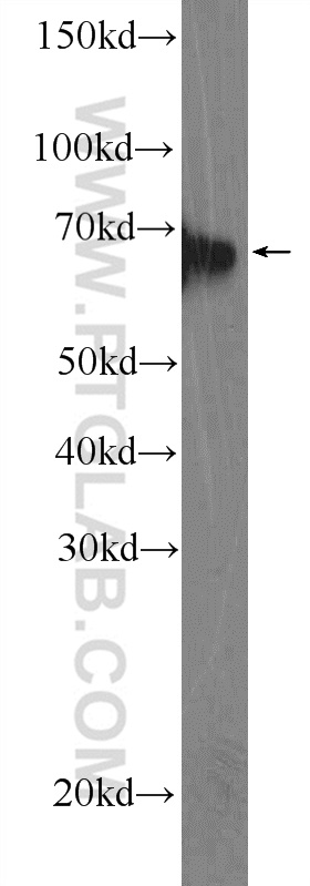 11482-1-AP;mouse brain tissue