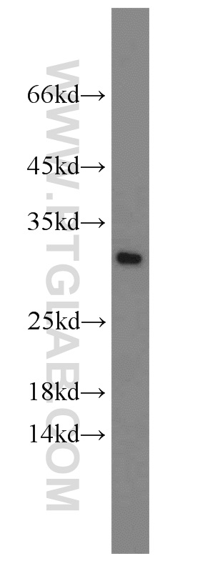 10291-1-AP;COLO 320 cell