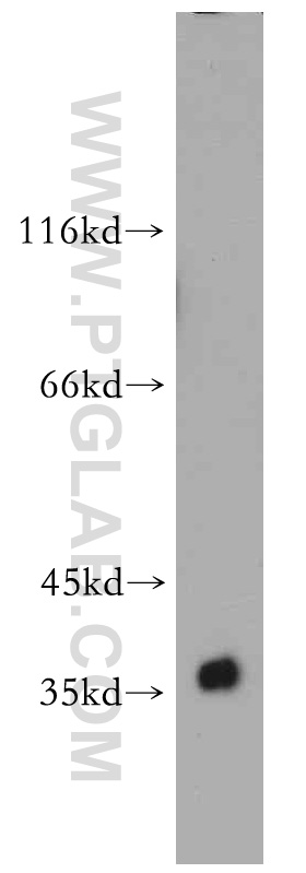 55047-1-AP;human brain tissue