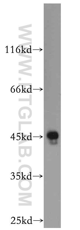 21160-1-AP;Raji cell