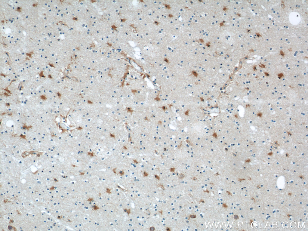 55237-1-AP;human brain