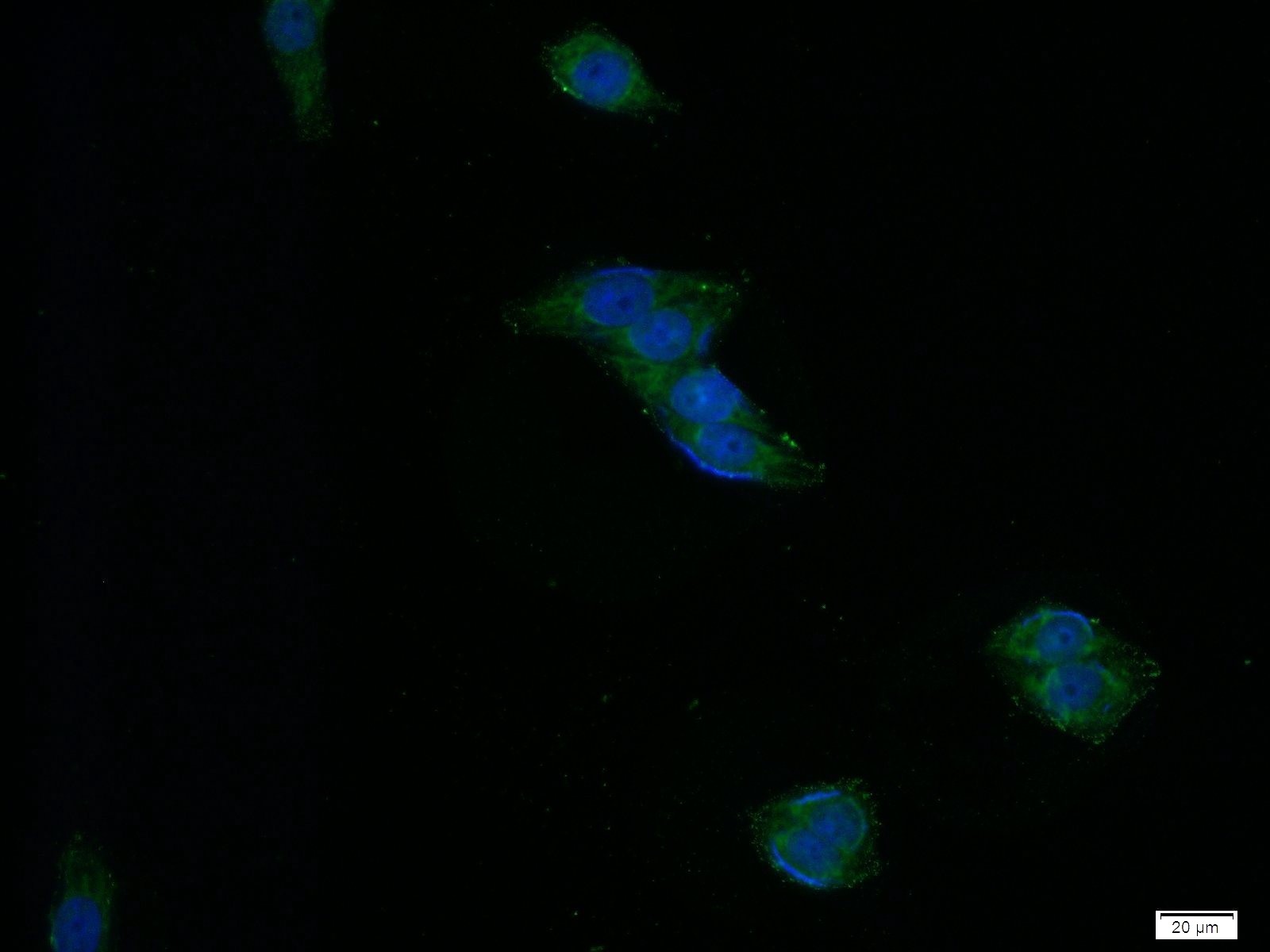 CD39/ENTPD1 Antibody 603231Ig Proteintech