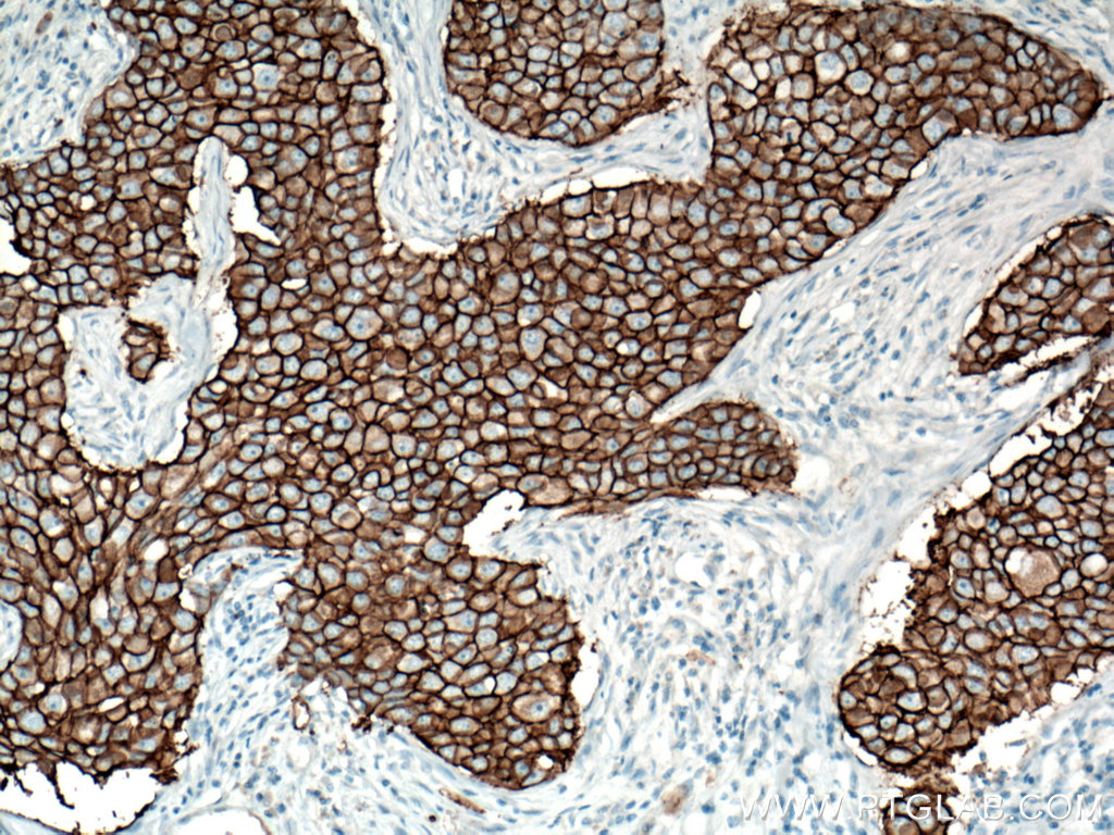 HER2/ErbB2 Antibody 603111Ig Proteintech