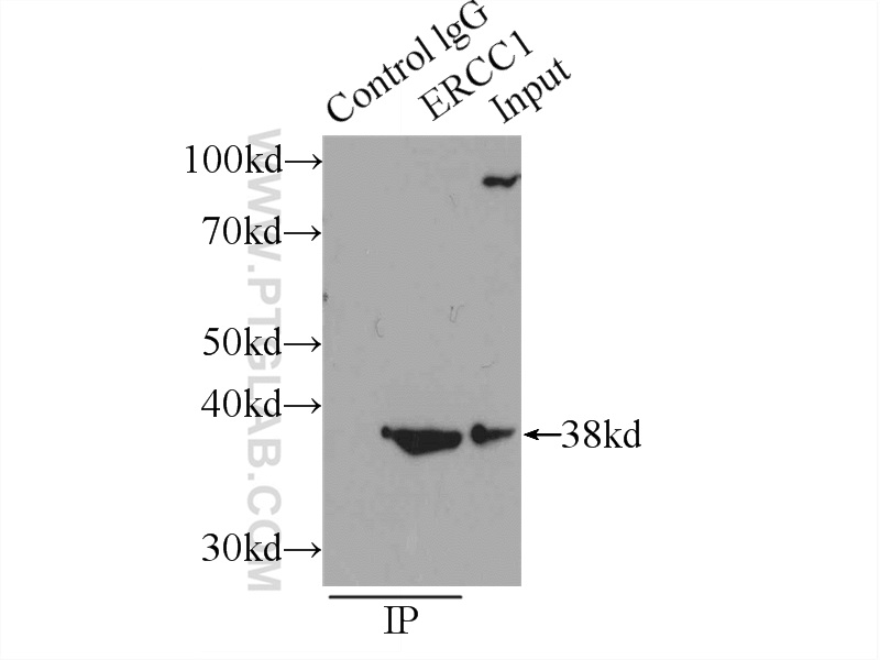 14586-1-AP;MCF-7 cells