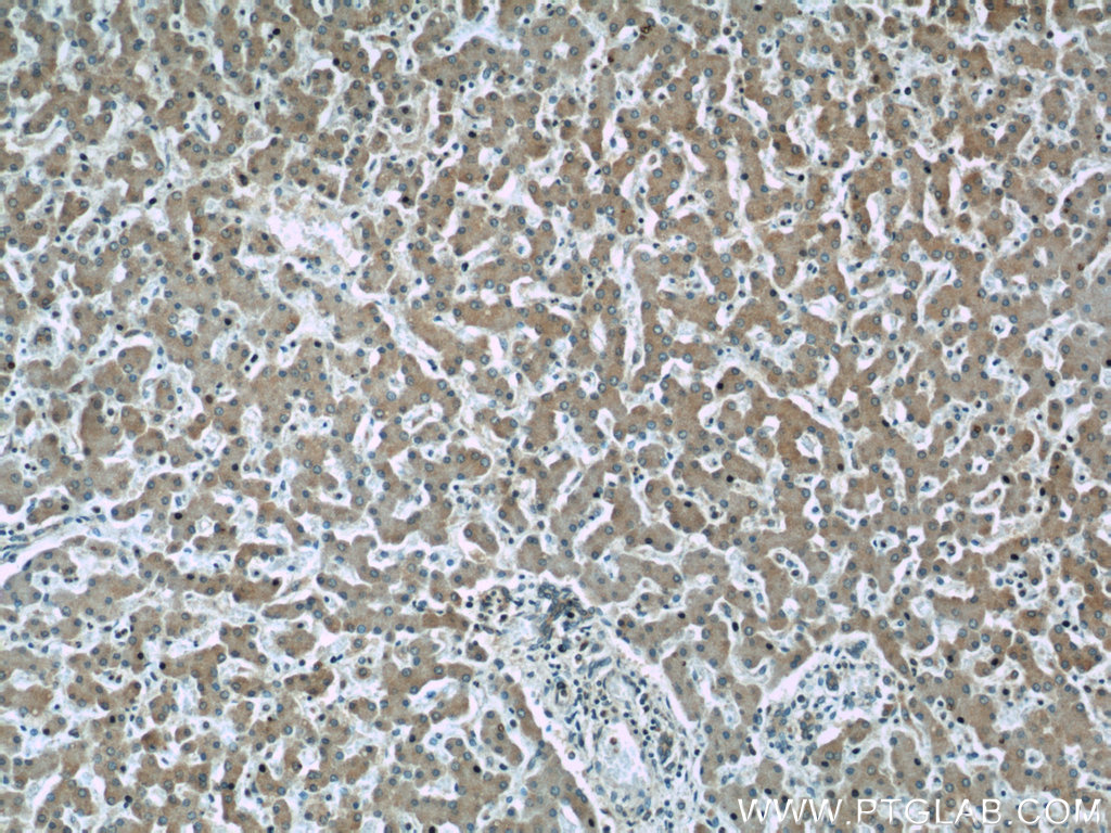 24344-1-AP;human liver