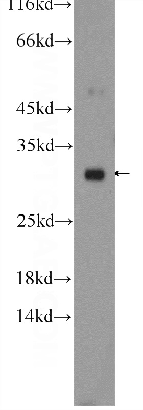 24344-1-AP;mouse liver tissue