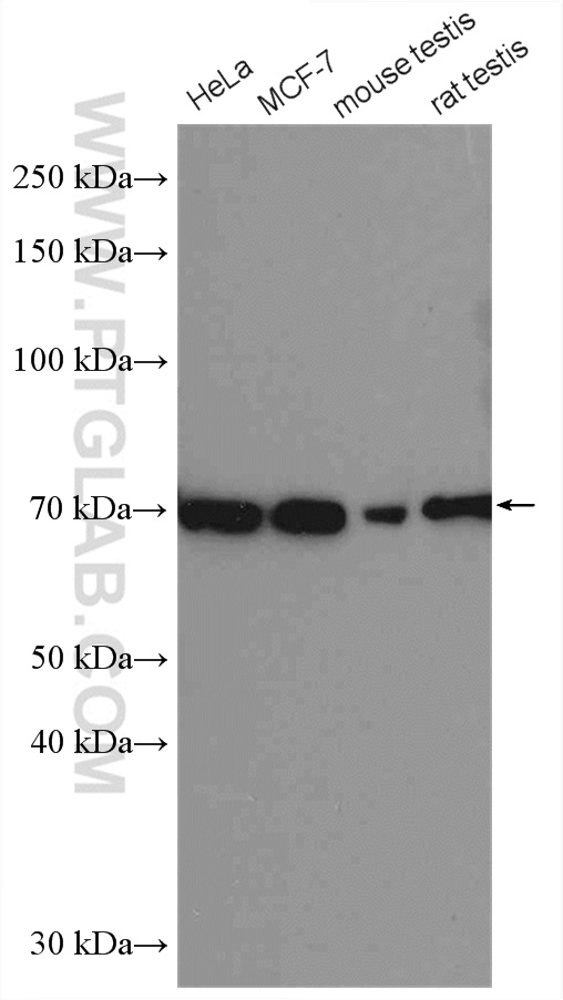 er-antibody-21244-1-ap-proteintech