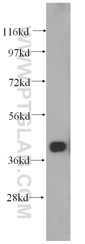 14928-1-AP;mouse liver tissue