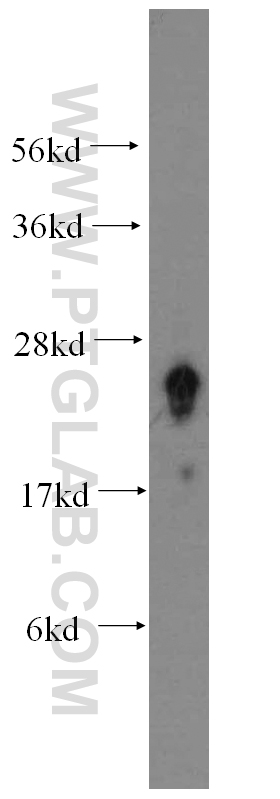 14247-1-AP;human brain tissue