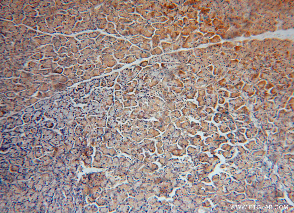 16341-1-AP;H-pancreas
