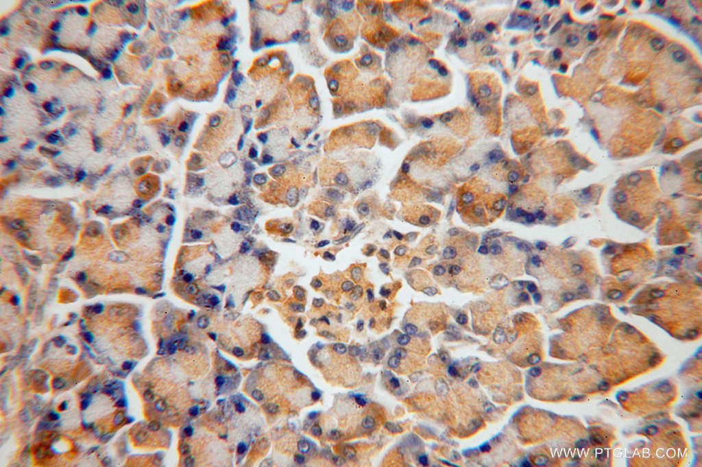 16341-1-AP;H-pancreas