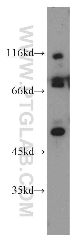 17464-1-AP;mouse brain tissue
