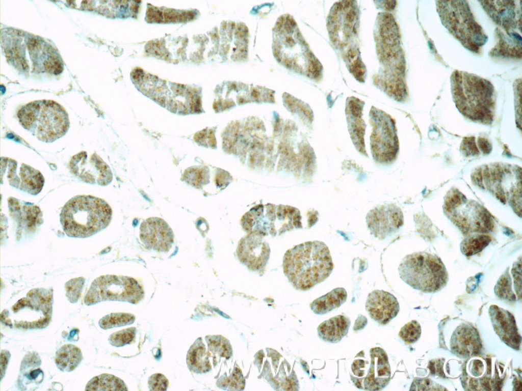 12844-1-AP;human heart tissue