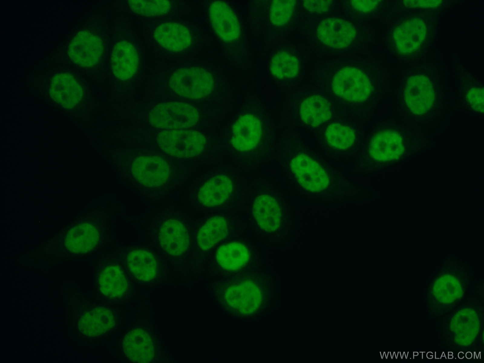 14275-1-AP;PC-3 cells