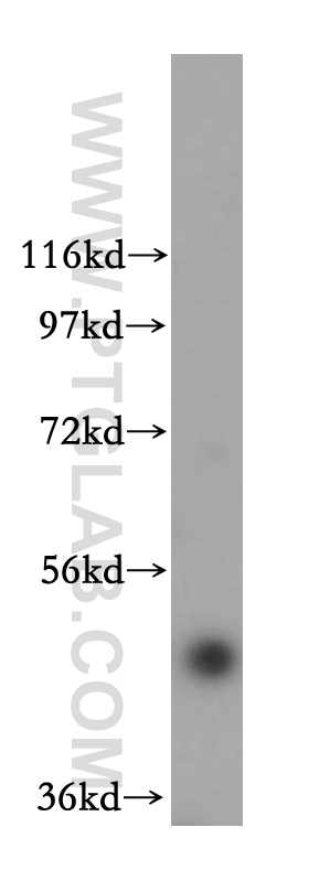 17803-1-AP;HeLa cells