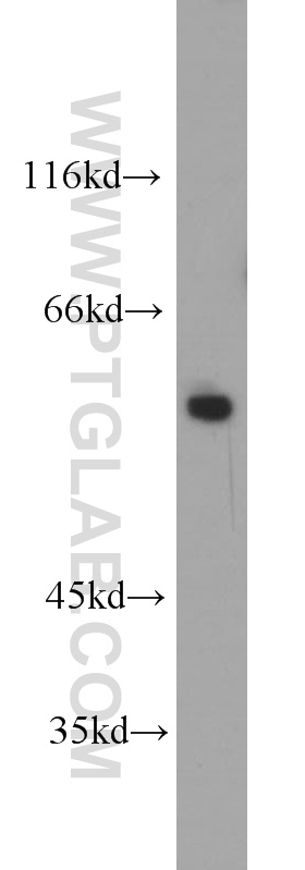 10872-1-AP;HEK-293 cells