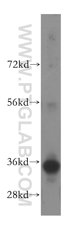 11775-1-AP;human liver tissue