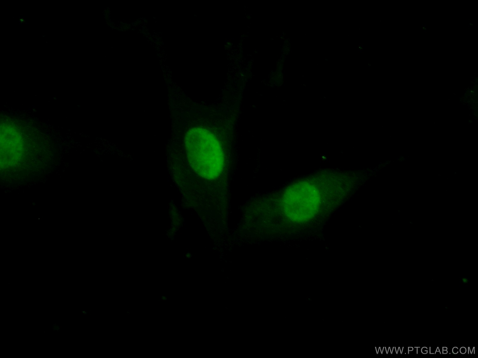 FEN1 Antibody 14768-1-AP | Proteintech