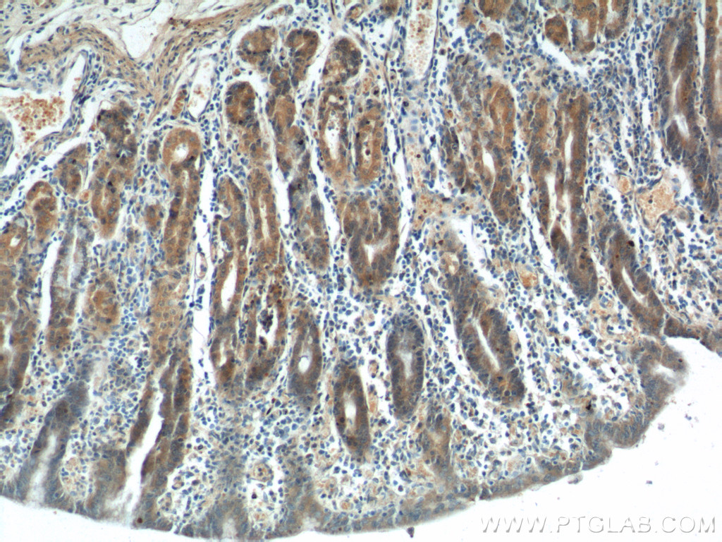 18171-1-AP;human stomach tissue