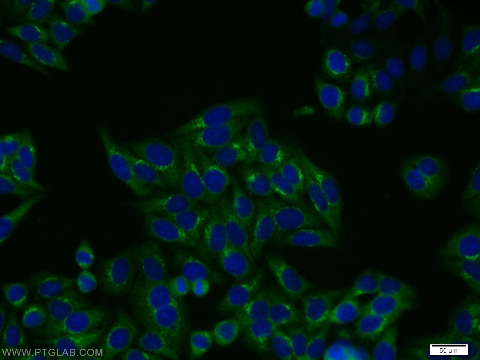 fgfr2-antibody-13042-1-ap-proteintech