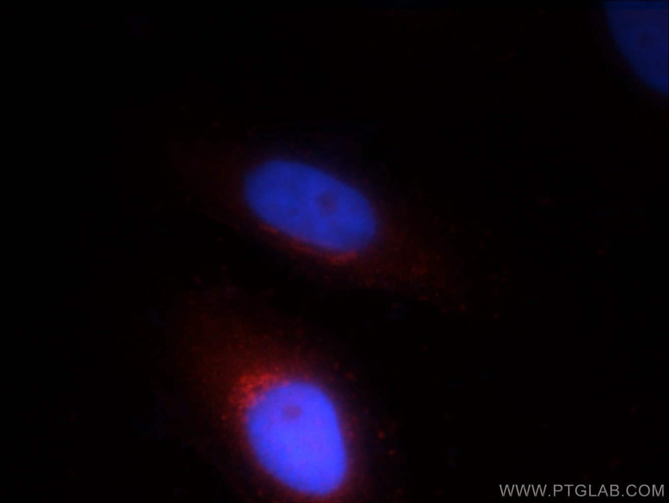 fgfr2-antibody-13042-1-ap-proteintech