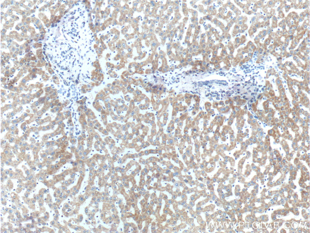 22605-1-AP;human liver tissue