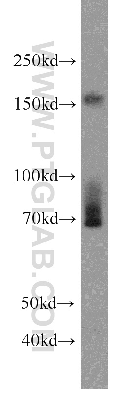 22605-1-AP;Jurkat cell