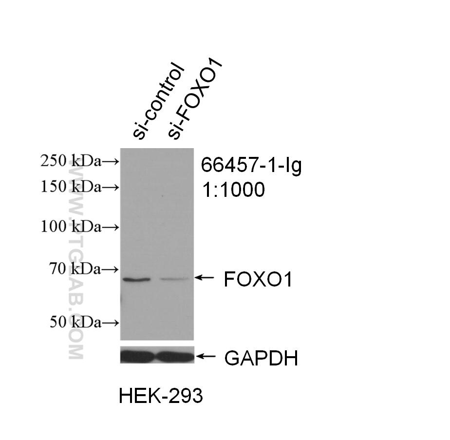 FOXO1 Antibody 664571Ig Proteintech
