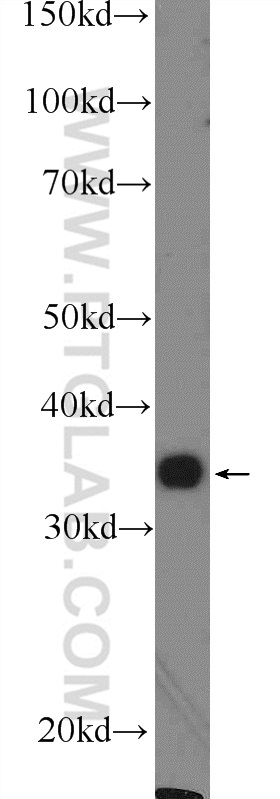 16234-1-AP;mouse liver tissue