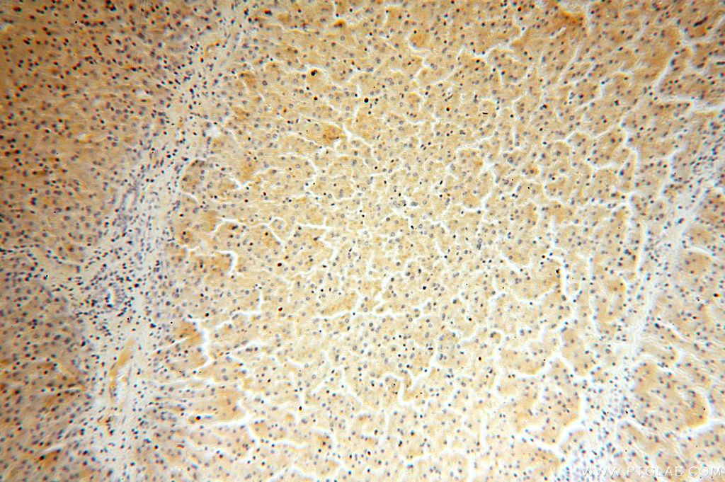 15157-1-AP;human liver