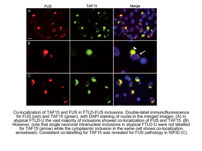 fus-tls-antibody-60160-1-ig-proteintech