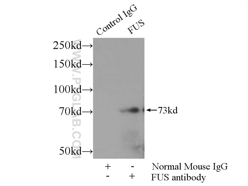 fus-tls-antibody-60160-1-ig-proteintech