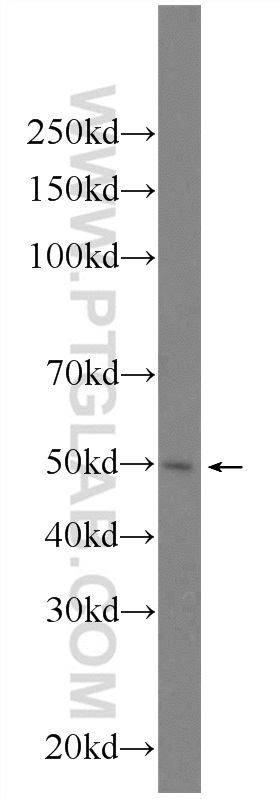 24560-1-AP;HeLa cells