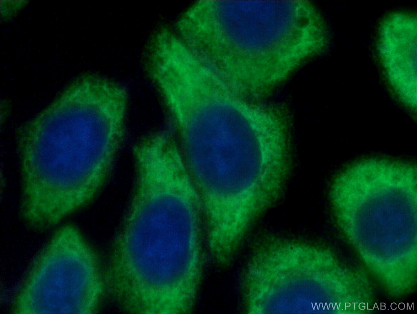 G3BP1 Antibody 13057 2 AP Proteintech g3bp1-antibody-13057-2-ap-proteintech
