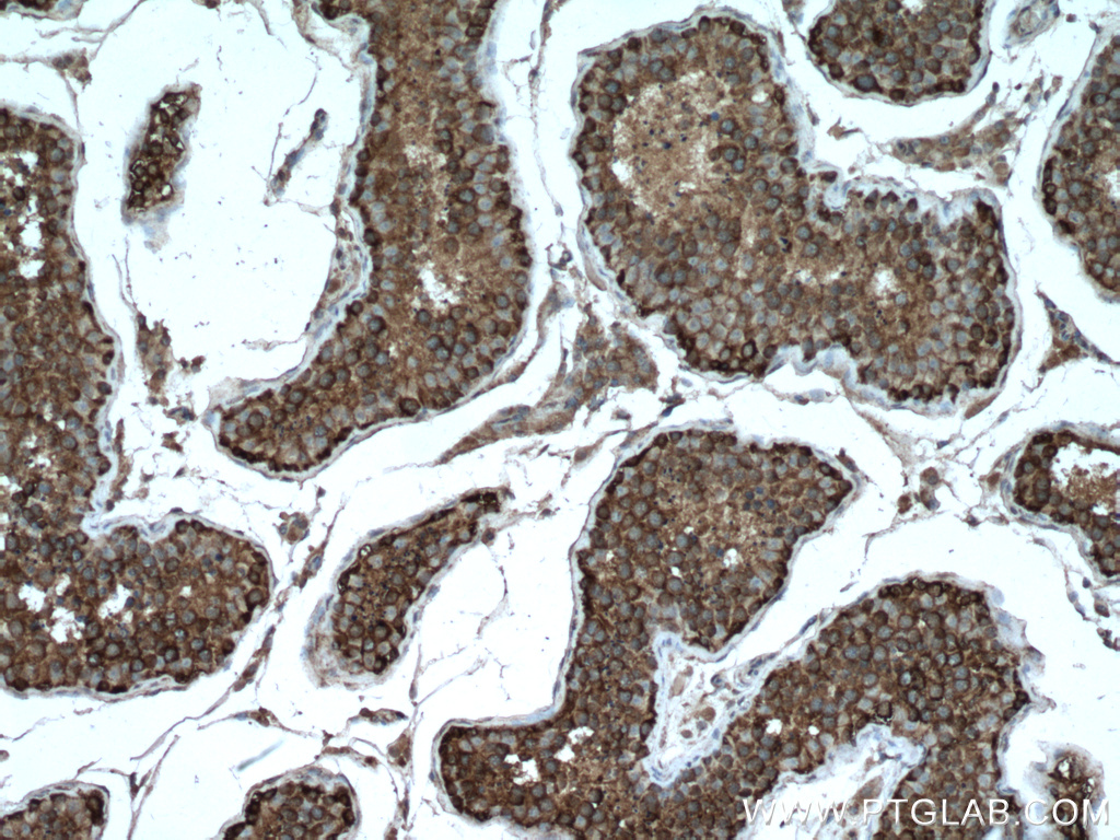 G3BP1 Antibody 13057 2 AP Proteintech g3bp1-antibody-13057-2-ap-proteintech