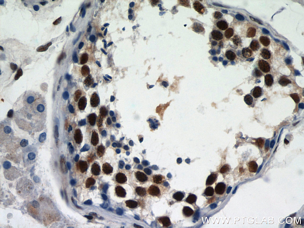 12597-1-AP;human testis tissue