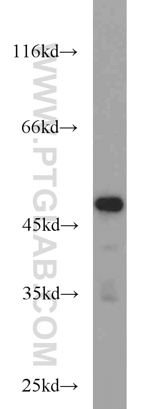 12597-1-AP;mouse lung tissue