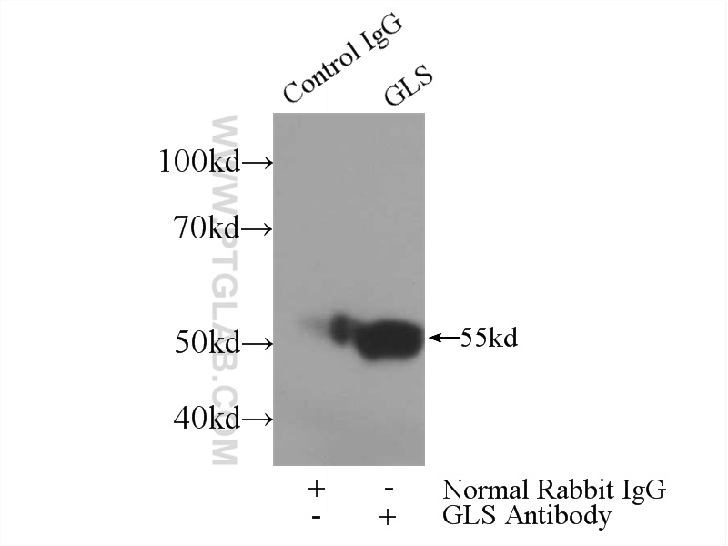 19958-1-AP;mouse kidney tissue