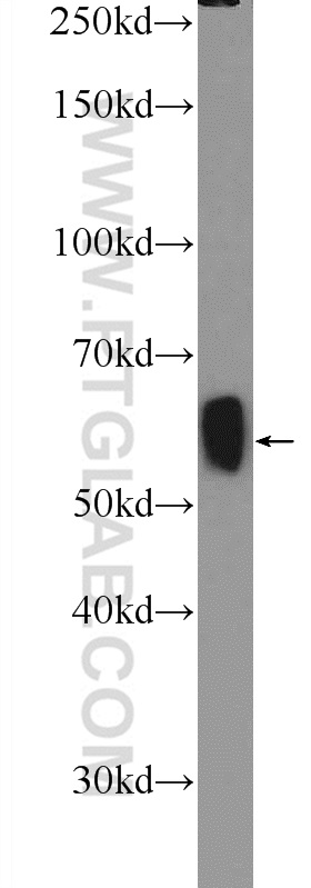 21760-1-AP;mouse brain tissue