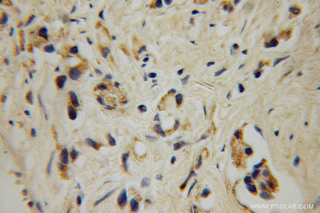 12897-1-AP;human prostate cancer