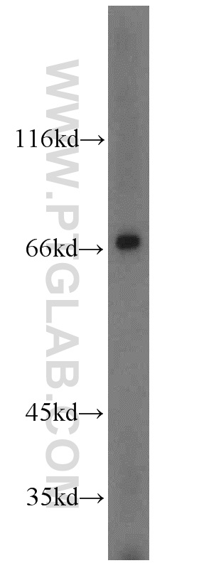12897-1-AP;HeLa cells