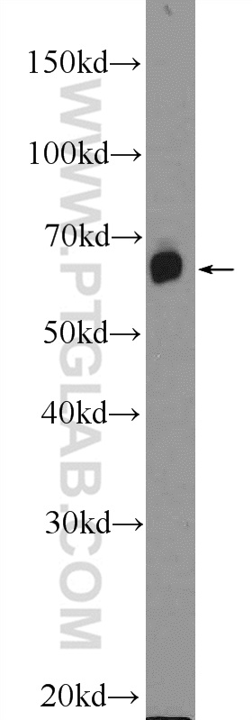 25967-1-AP;mouse brain tissue