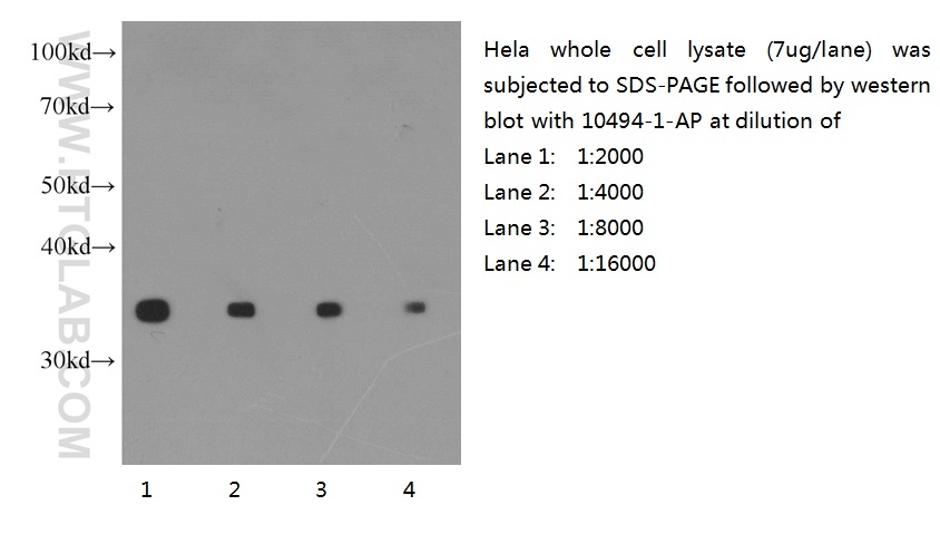 10494-1-AP;HeLa cells